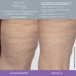 Better Together WellSpa iO System Revitalise Focus